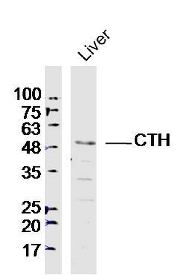 CTH Antibody in Western Blot (WB)