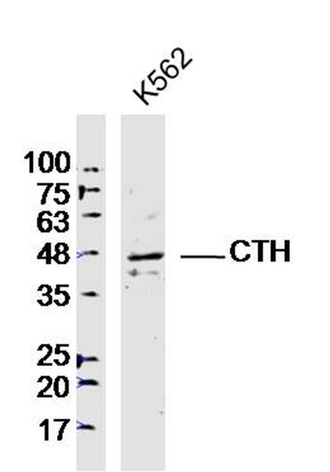 CTH Antibody in Western Blot (WB)