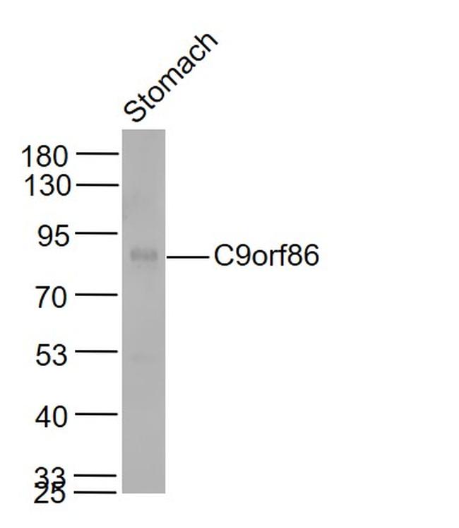 C9orf86 Antibody in Western Blot (WB)