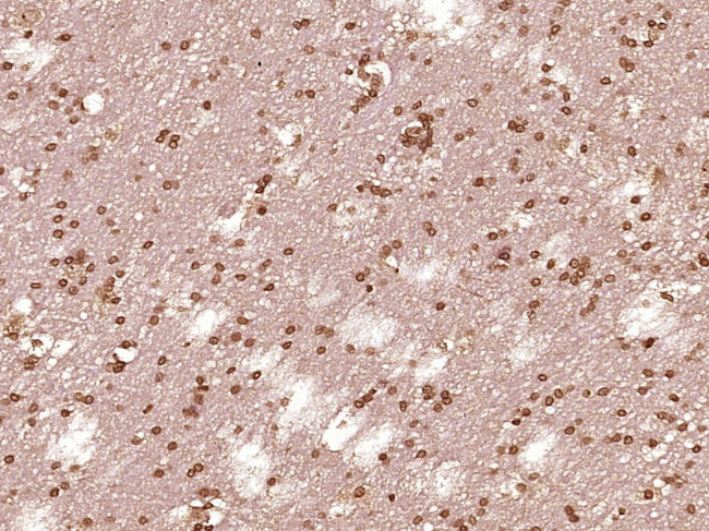 STAT1 p84/p91 Antibody in Immunohistochemistry (Paraffin) (IHC (P))