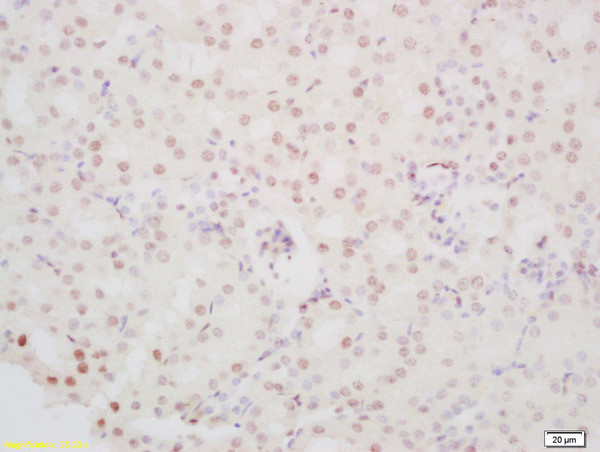 PINX-1 Antibody in Immunohistochemistry (Paraffin) (IHC (P))