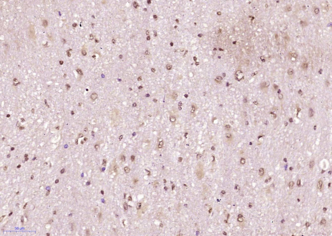 Phospho-SRF (Ser77) Antibody in Immunohistochemistry (Paraffin) (IHC (P))