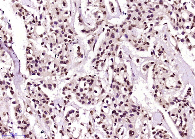 Phospho-SRF (Ser77) Antibody in Immunohistochemistry (Paraffin) (IHC (P))