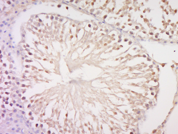 C17orf64 Antibody in Immunohistochemistry (Paraffin) (IHC (P))