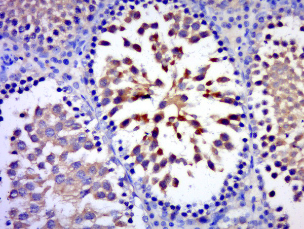 C17orf75 Antibody in Immunohistochemistry (Paraffin) (IHC (P))