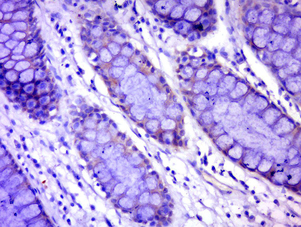 C17orf82 Antibody in Immunohistochemistry (Paraffin) (IHC (P))