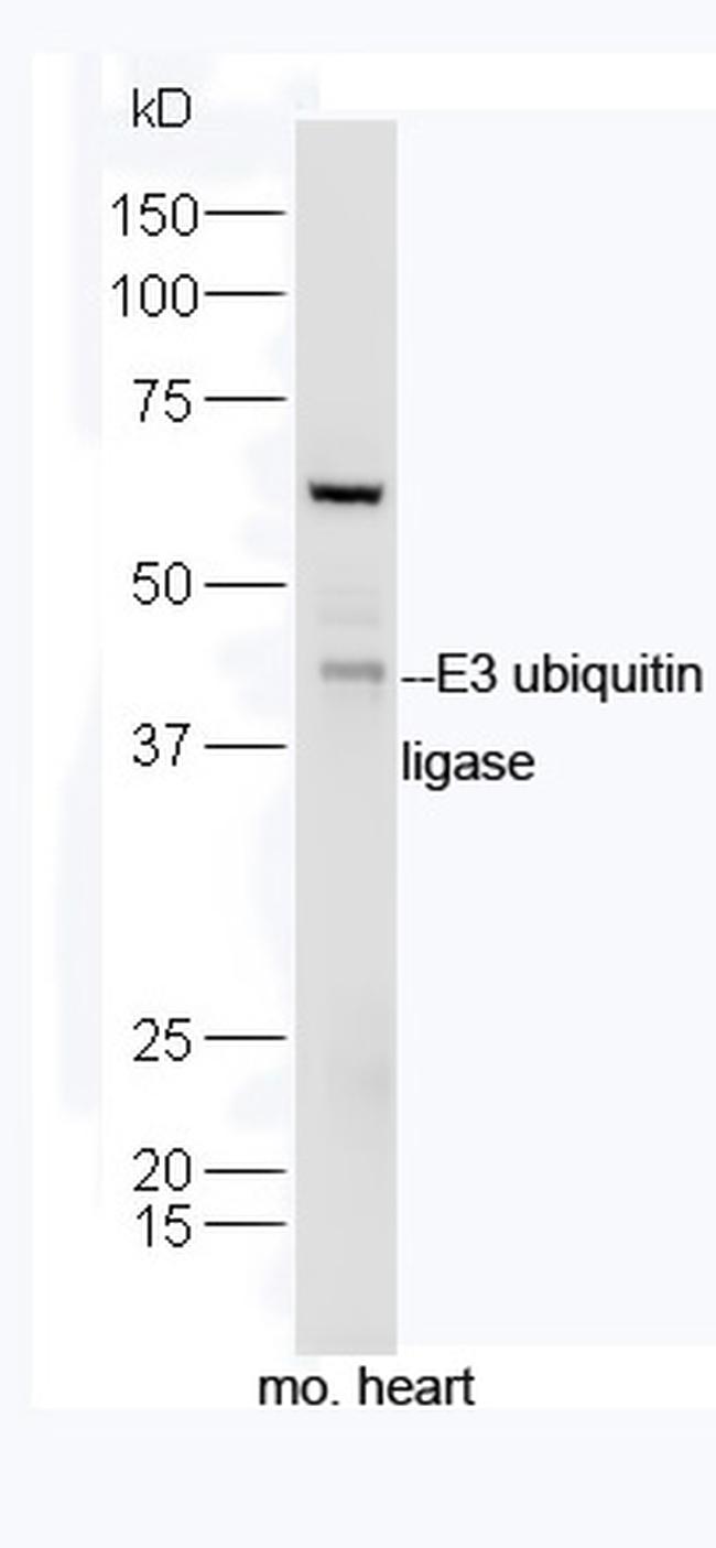 E3 ubiquitin ligase Antibody in Western Blot (WB)