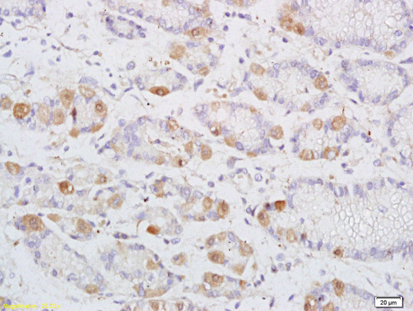 DENND2D Antibody in Immunohistochemistry (Paraffin) (IHC (P))