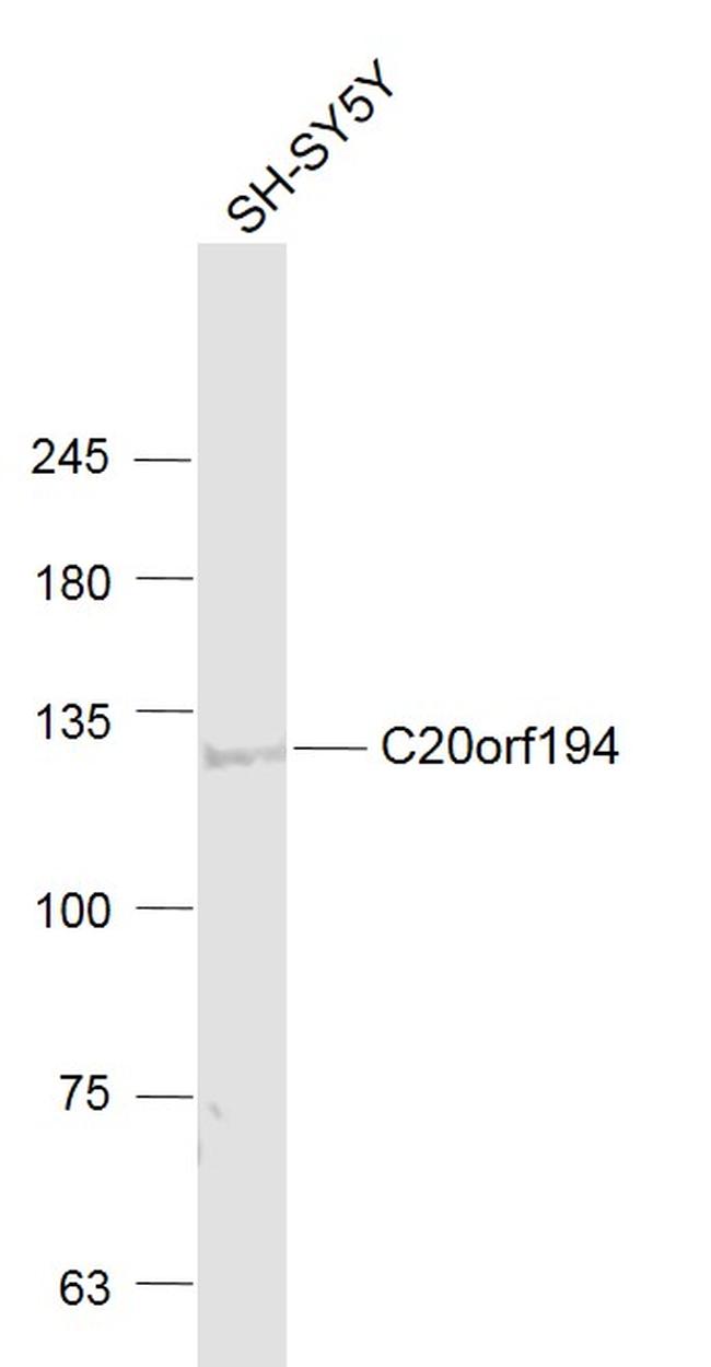 C20orf194 Antibody in Western Blot (WB)