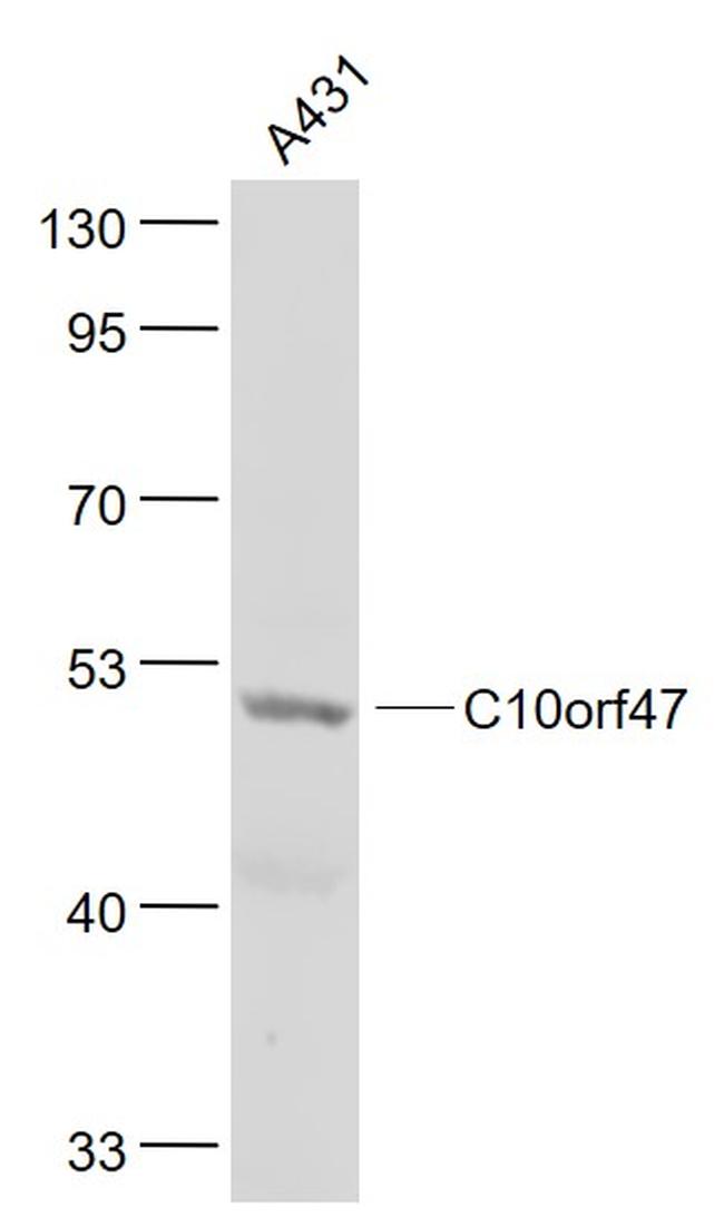 C10orf47 Antibody in Western Blot (WB)