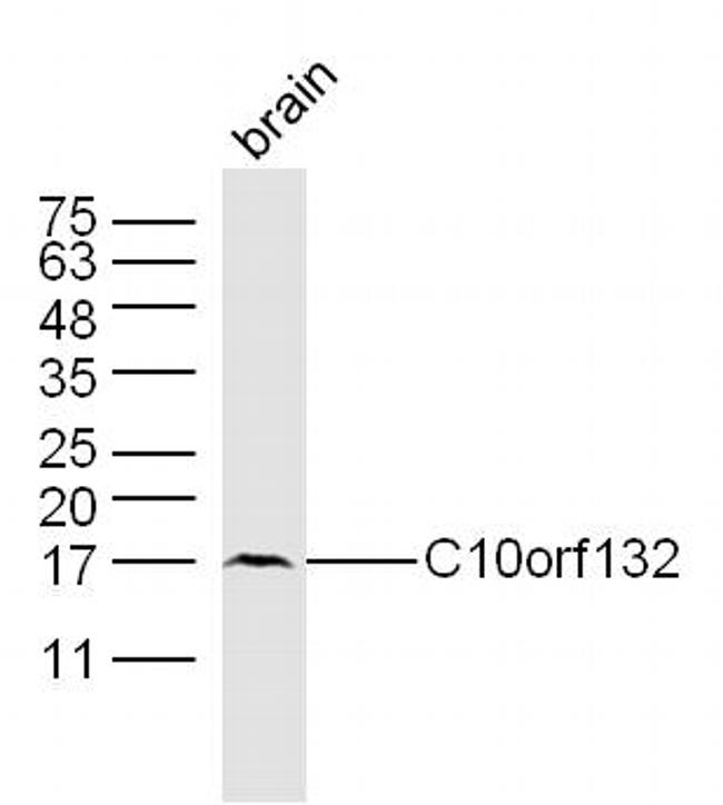 C10orf132 Antibody in Western Blot (WB)