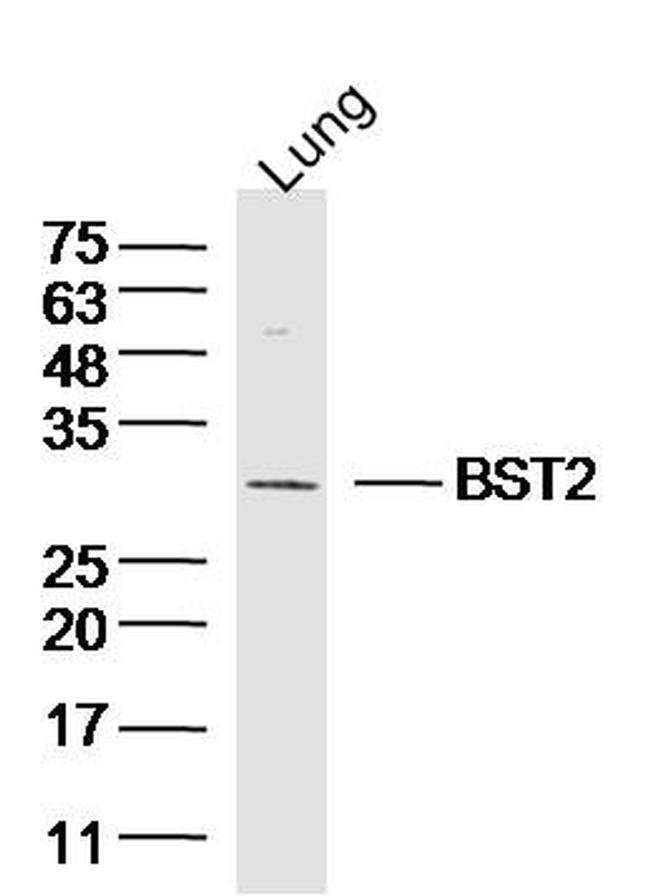 BST2/CD317 Antibody in Western Blot (WB)