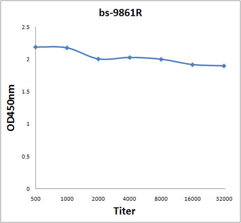 Titin Antibody in ELISA (ELISA)