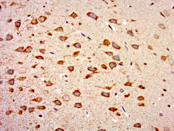 WIPF2 Antibody in Immunohistochemistry (Paraffin) (IHC (P))