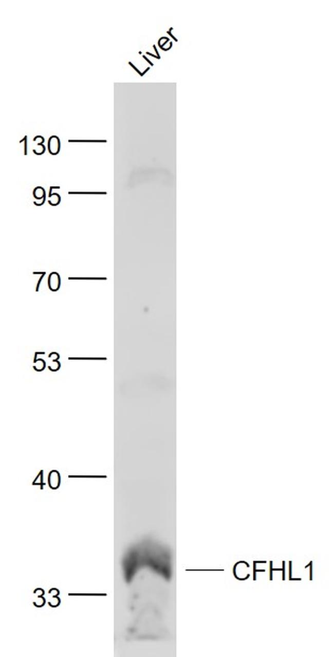 CFHL1 Antibody in Western Blot (WB)