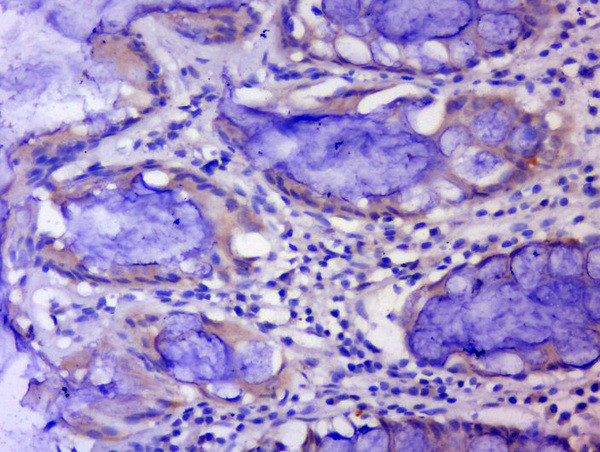 CWH43 Antibody in Immunohistochemistry (Paraffin) (IHC (P))