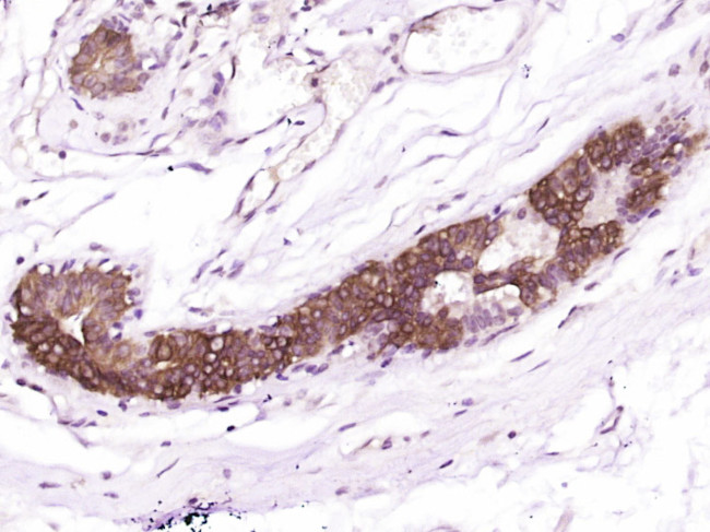 CWH43 Antibody in Immunohistochemistry (Paraffin) (IHC (P))