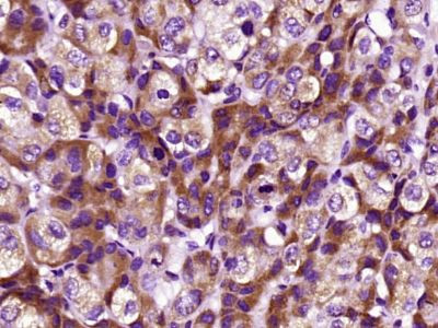 CRP Antibody in Immunohistochemistry (Paraffin) (IHC (P))