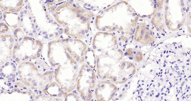 CRP Antibody in Immunohistochemistry (Paraffin) (IHC (P))