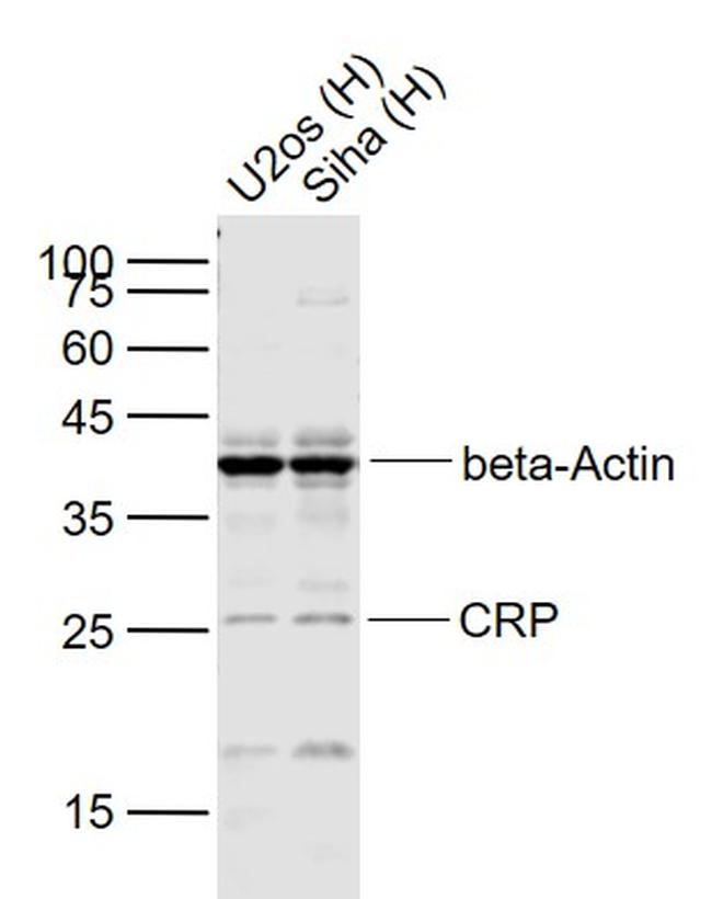 CRP Antibody in Western Blot (WB)