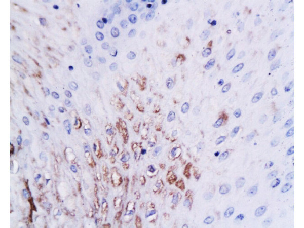 PAG608 Antibody in Immunohistochemistry (Paraffin) (IHC (P))