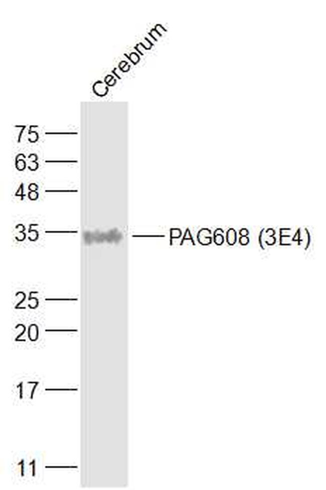 PAG608 Antibody in Western Blot (WB)