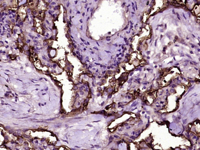 ICAM1/CD54 Antibody in Immunohistochemistry (Paraffin) (IHC (P))