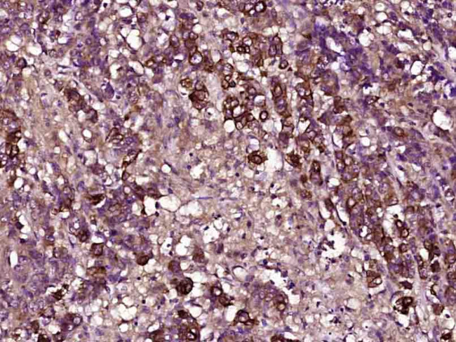 TIMP-1 Antibody in Immunohistochemistry (Paraffin) (IHC (P))