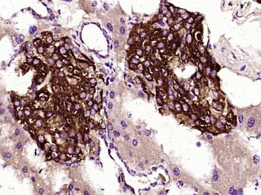 TIMP-1 Antibody in Immunohistochemistry (Paraffin) (IHC (P))