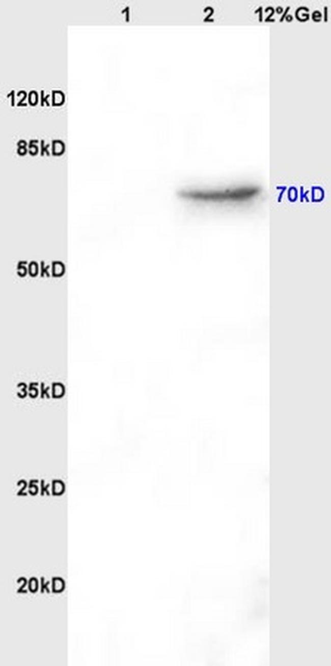 AFP Antibody in Western Blot (WB)