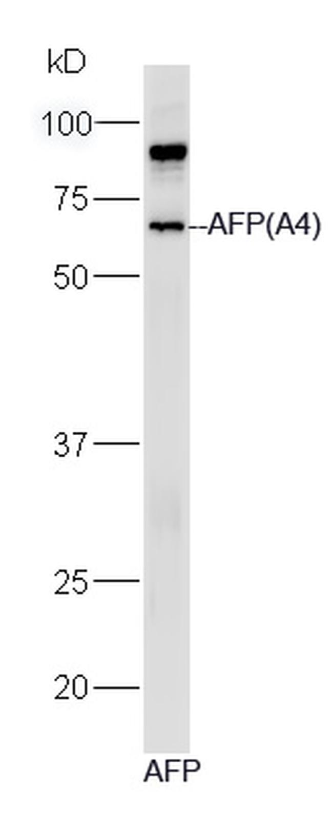 AFP Antibody in Western Blot (WB)