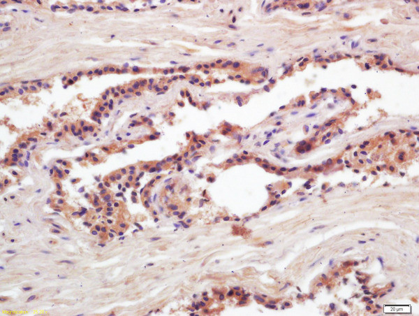 PSA Antibody in Immunohistochemistry (Paraffin) (IHC (P))