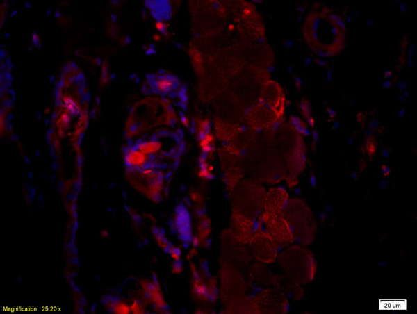 HBsAg Antibody in Immunohistochemistry (Paraffin) (IHC (P))