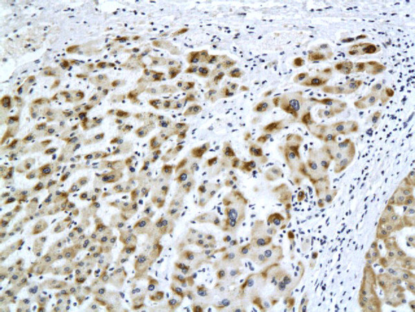 HBsAg Antibody in Immunohistochemistry (Paraffin) (IHC (P))