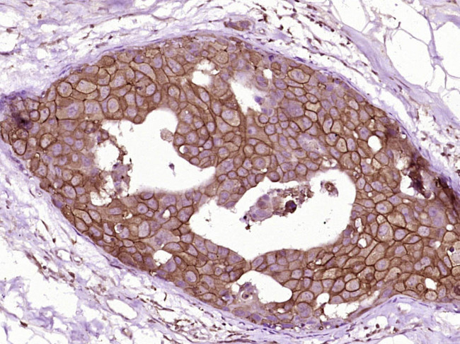 C-erbB-2/HER2 Antibody in Immunohistochemistry (Paraffin) (IHC (P))