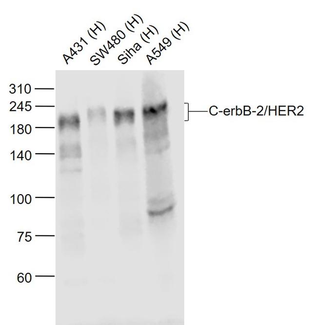 C-erbB-2/HER2 Antibody in Western Blot (WB)