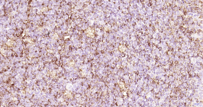 CD45 Antibody in Immunohistochemistry (Paraffin) (IHC (P))