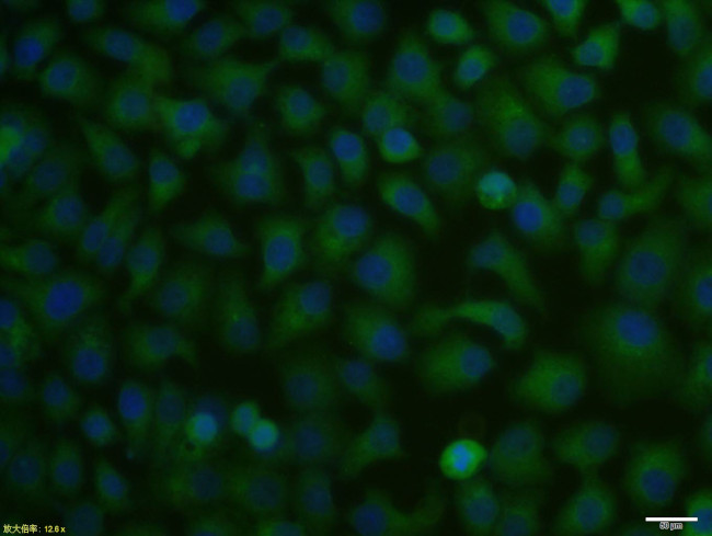 Cytokeratin 19 Antibody in Immunocytochemistry (ICC/IF)