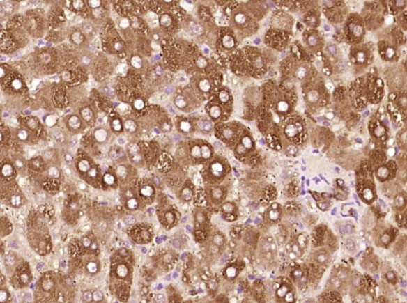 Cytokeratin 19 Antibody in Immunohistochemistry (Paraffin) (IHC (P))