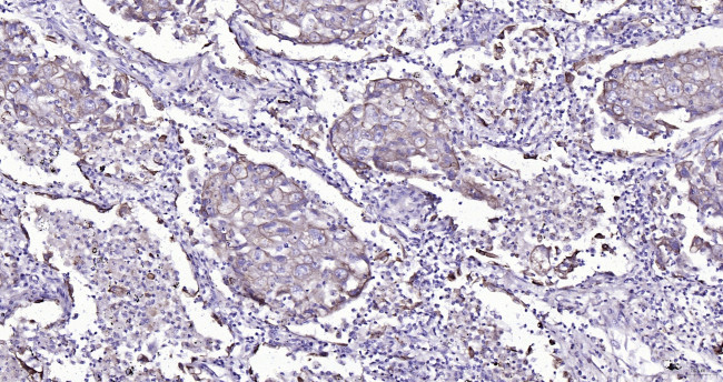 Cytokeratin 19 Antibody in Immunohistochemistry (Paraffin) (IHC (P))