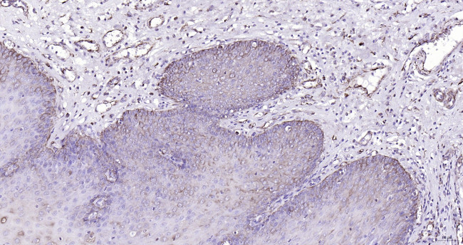 Cytokeratin 19 Antibody in Immunohistochemistry (Paraffin) (IHC (P))