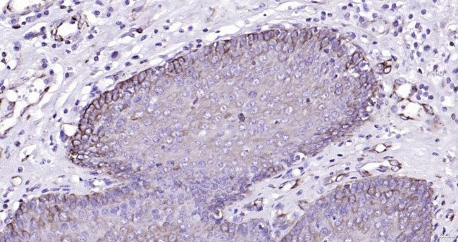 Cytokeratin 19 Antibody in Immunohistochemistry (Paraffin) (IHC (P))