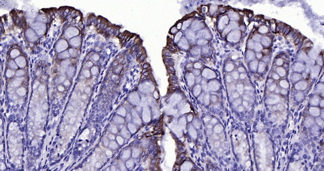 Cytokeratin 19 Antibody in Immunohistochemistry (Paraffin) (IHC (P))