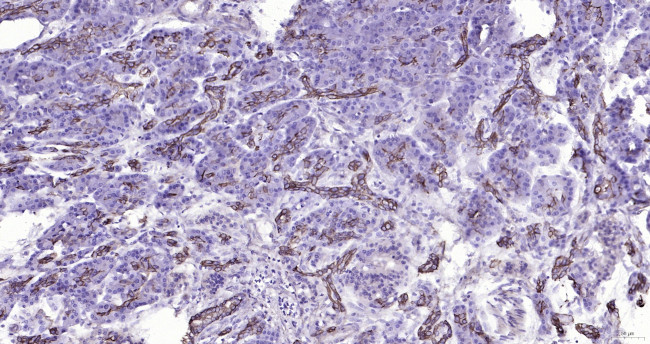 Cytokeratin 19 Antibody in Immunohistochemistry (Paraffin) (IHC (P))