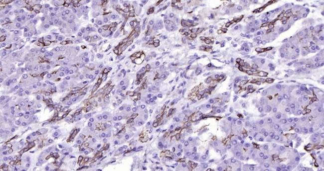 Cytokeratin 19 Antibody in Immunohistochemistry (Paraffin) (IHC (P))