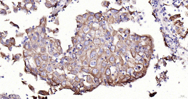 Cytokeratin 19 Antibody in Immunohistochemistry (Paraffin) (IHC (P))