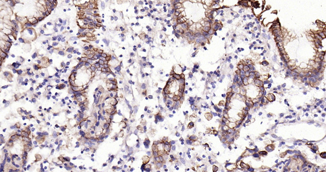 Cytokeratin 19 Antibody in Immunohistochemistry (Paraffin) (IHC (P))