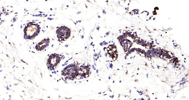 Cytokeratin 19 Antibody in Immunohistochemistry (Paraffin) (IHC (P))