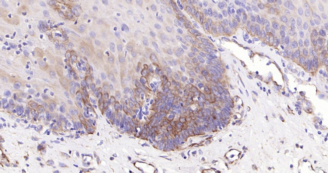 Cytokeratin 19 Antibody in Immunohistochemistry (Paraffin) (IHC (P))