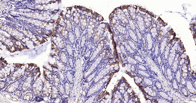 Cytokeratin 19 Antibody in Immunohistochemistry (Paraffin) (IHC (P))